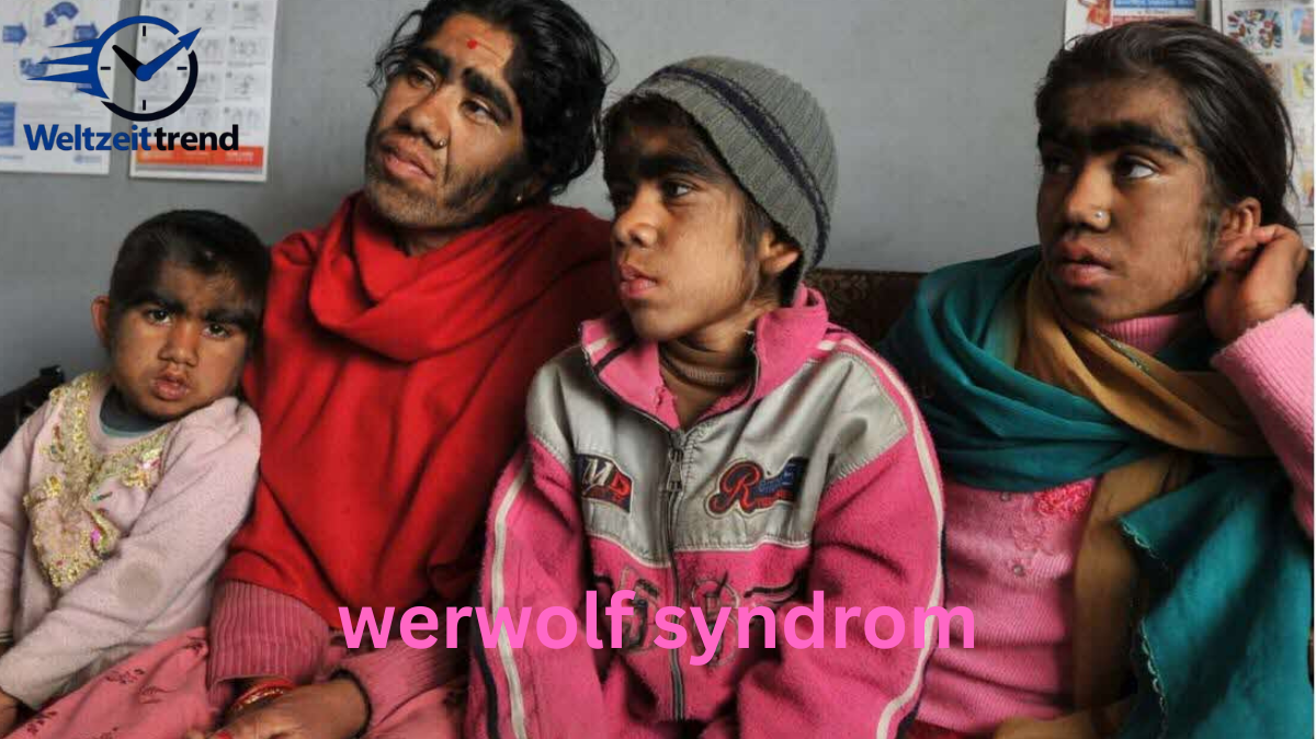 werwolf syndrom